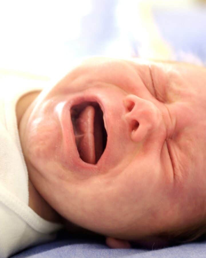 Is Tongue Tie Just an Internet Fad?