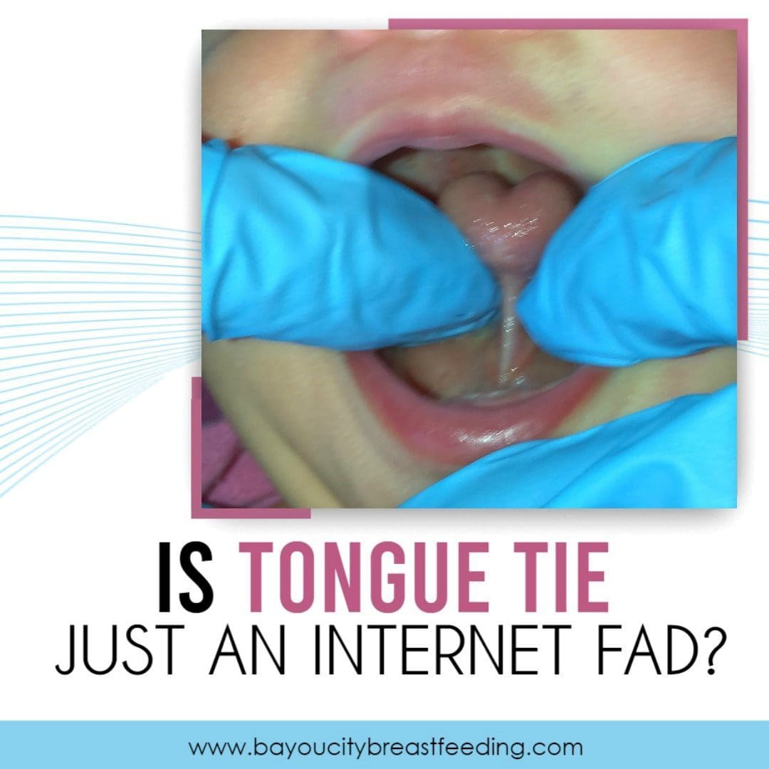 Is Tongue Tie Just An Internet Fad Poster in White Color