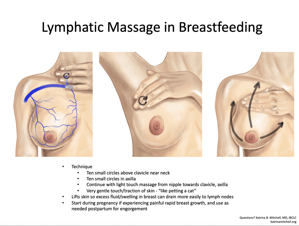 Lymphatic massage for mastitis